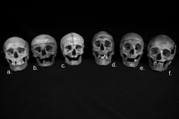 Bony White sex omeka projects fullsize bdf deb exhibits show ohio bones crania