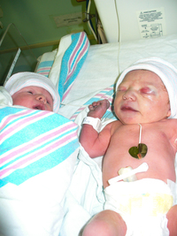 Stella Baby xxx photo alices twin birth story